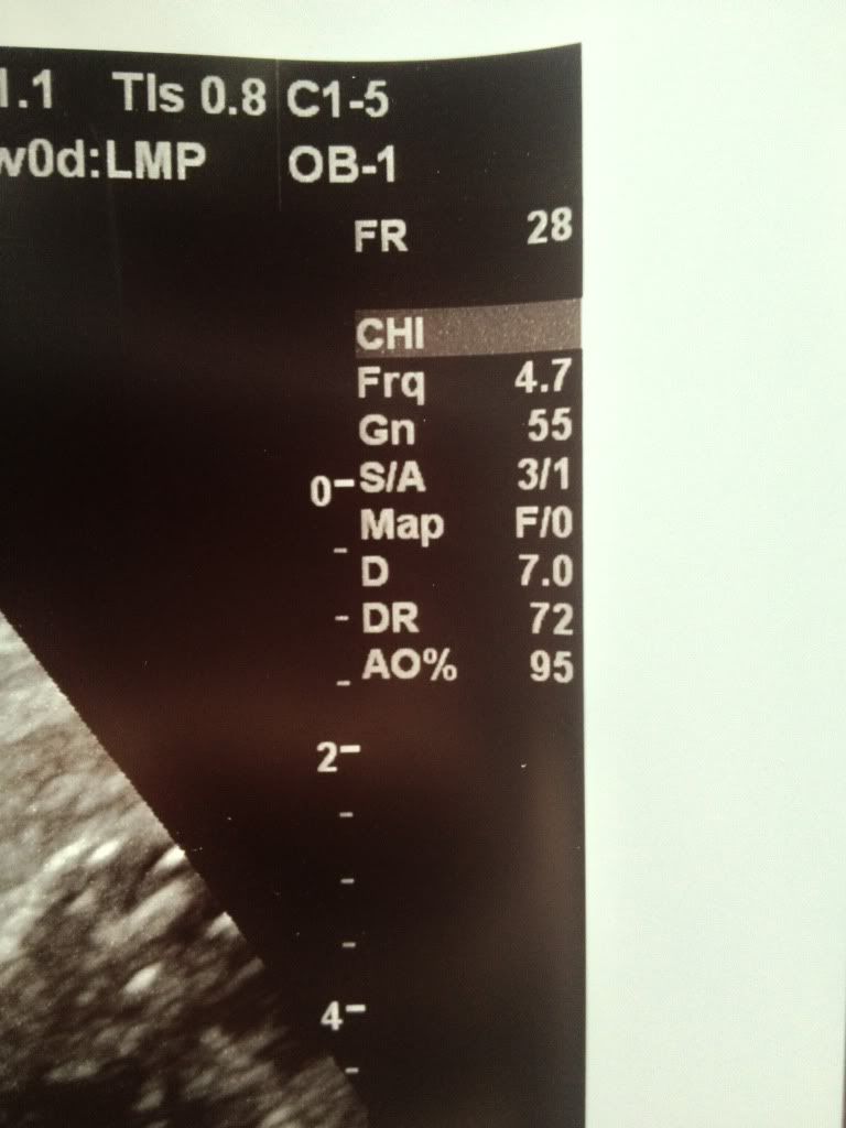 Ultrasound abbreviations? 10 weeks 5 days BabyandBump