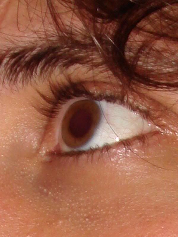 eye_daisy2007.jpg