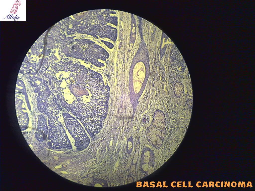 oral pathology slides